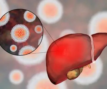 Día Mundial contra la Hepatitis (OMS)